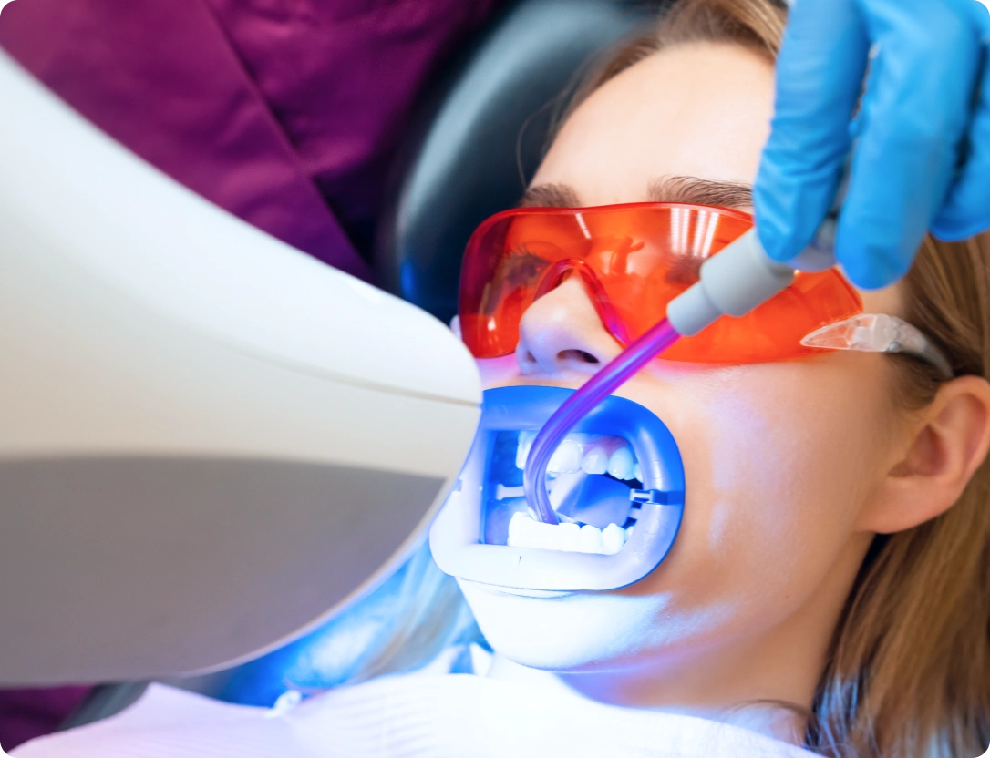 etica-dental-especialidades-blanqueamiento-dental-salud-bucal@2x