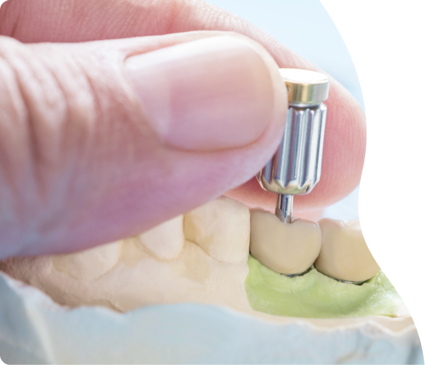 etica-dental-especialidades-implantes-clinica-dental-desktop (1)