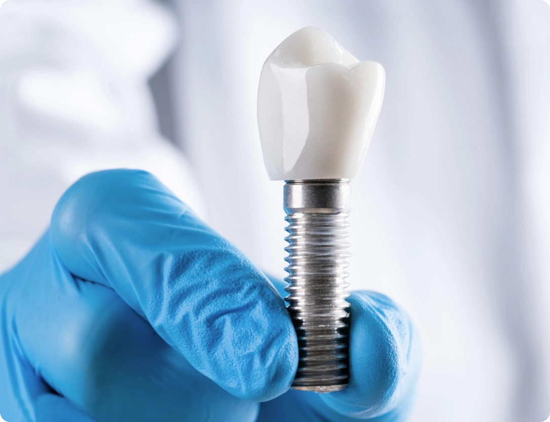 etica-dental-especialidades-implantes-clinica-dental-desktop