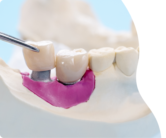 etica-dental-especialidades-implantes-estetica-dental-desktop (1)