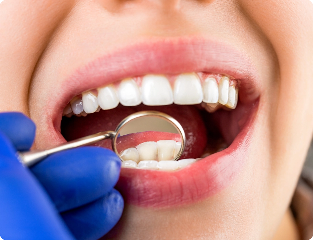 etica-dental-especialidades-periodoncia-clinica-dental-desktop@2x