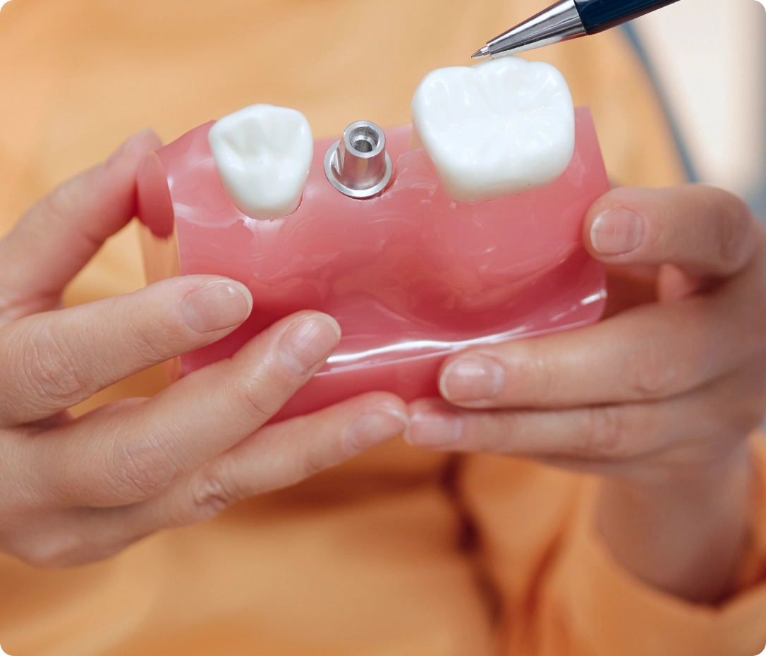 etica-dental-especialidades-protesis-dental-clinica-dental-desktop@2x