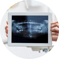 etica-dental-quienes-somos-implantes-dentales-desktop@2x